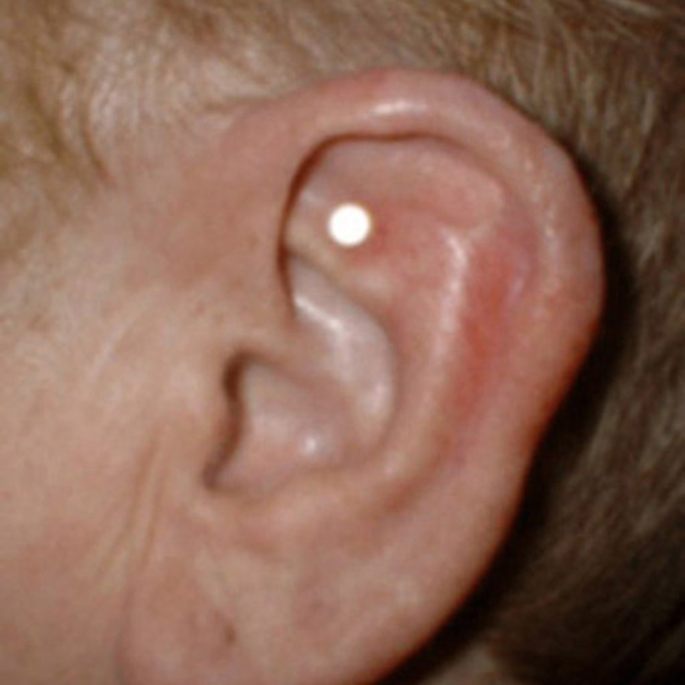 Hunger Control Acupressure Magnets - Picture 2 of 7